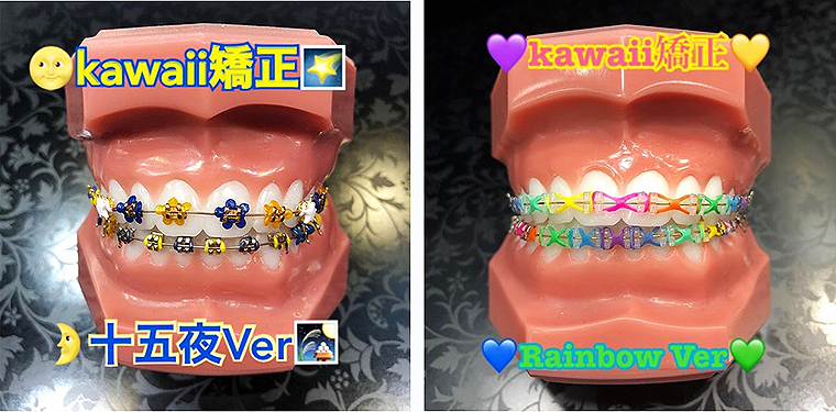 新矯正装置ビジュアルガイド チェアサイド・ラボサイドの 新矯正装置ビジュアルガイド | 後藤