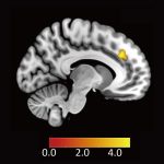 NICT 情報通信研究機構　交渉の場で不公平な提案を受け入れるときの脳内メカニズムを解明　脳の背側前帯状皮質が感情を抑えていた　納得性の高い分配制度設計に貢献できると期待